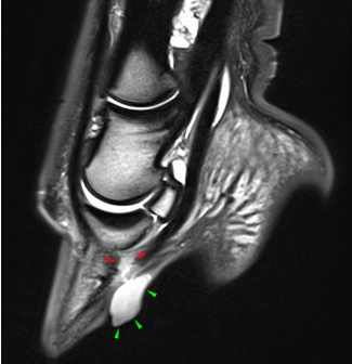 MRI 1 (2)-1